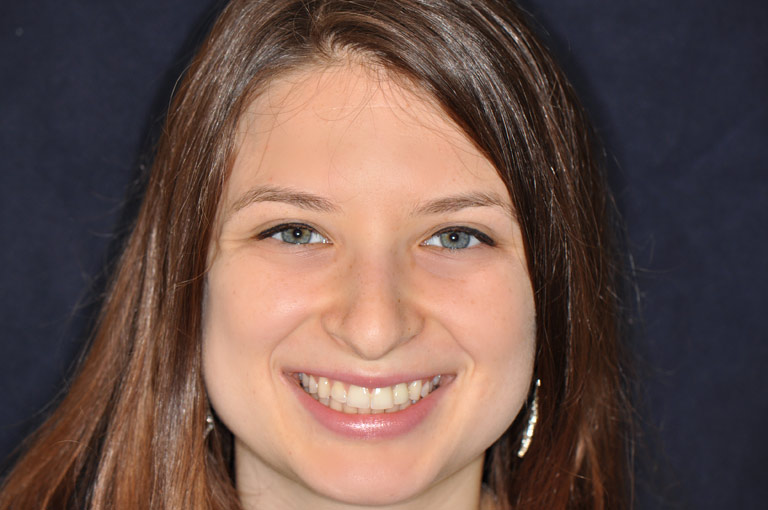 Headshot photo of female patient smiling after smile makeover