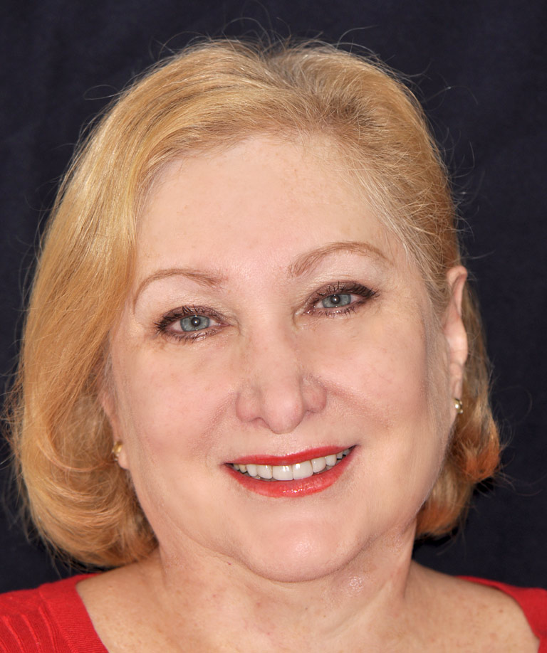 Headshot photo of Arlene smiling showing smile makeover results from Weiss
