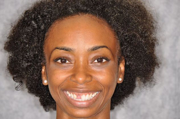 Headshot photo of young african-american woman smiling showing missing tooth before smile makeover