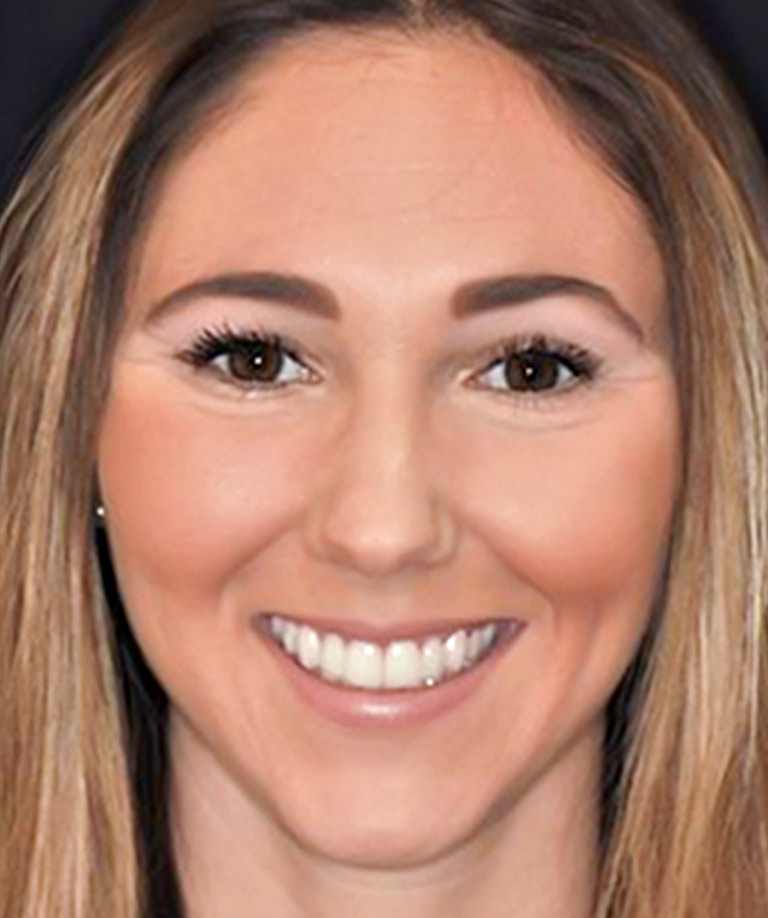 Headshot photo of Gabby smiling showing dental bonding results from Dr. Weiss