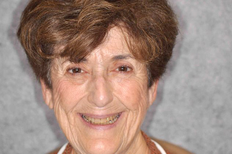 Headshot photo of older woman with glasses smiling showing teeth before smile makeover