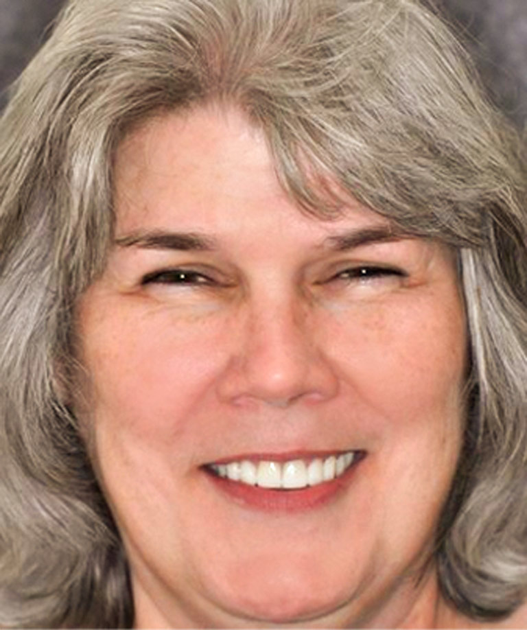 Headshot photo of woman with gray hair smiling showing smile makeover results from Weiss