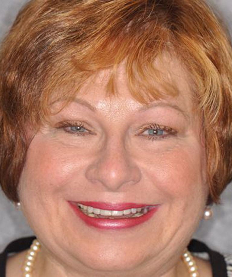 Headshot photo of short red-haired woman smiling showing smile makeover results from Dr. Weiss