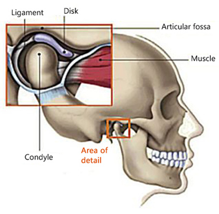 Diagram of the temporomandibular joint with the mandibular condyle resting in the articular fossa of the skull and the disk and the ligament between are attached to the muscle; for information on dentists in Philadelphia treating TMJ disorder.
