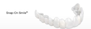 snap on smile