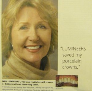 Advertisement for Lumineers over dental crowns