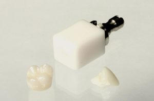 CEREC crown block
